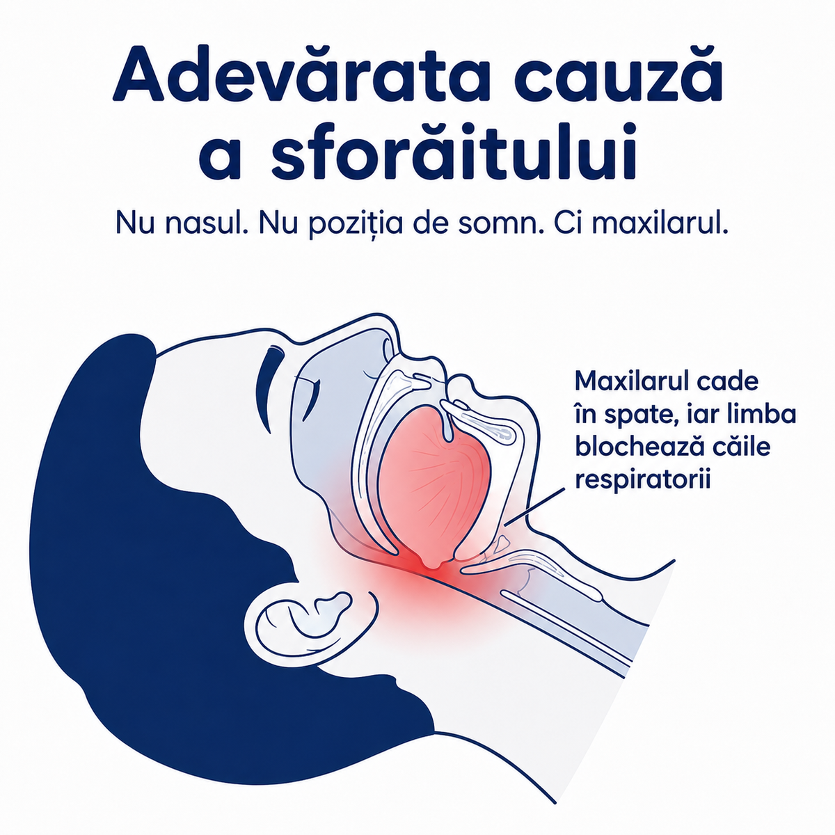 Opreste sforaitul inca din prima noapte – RestLab (+ CASETA IGIENICA DE PROTECTIE CADOU)