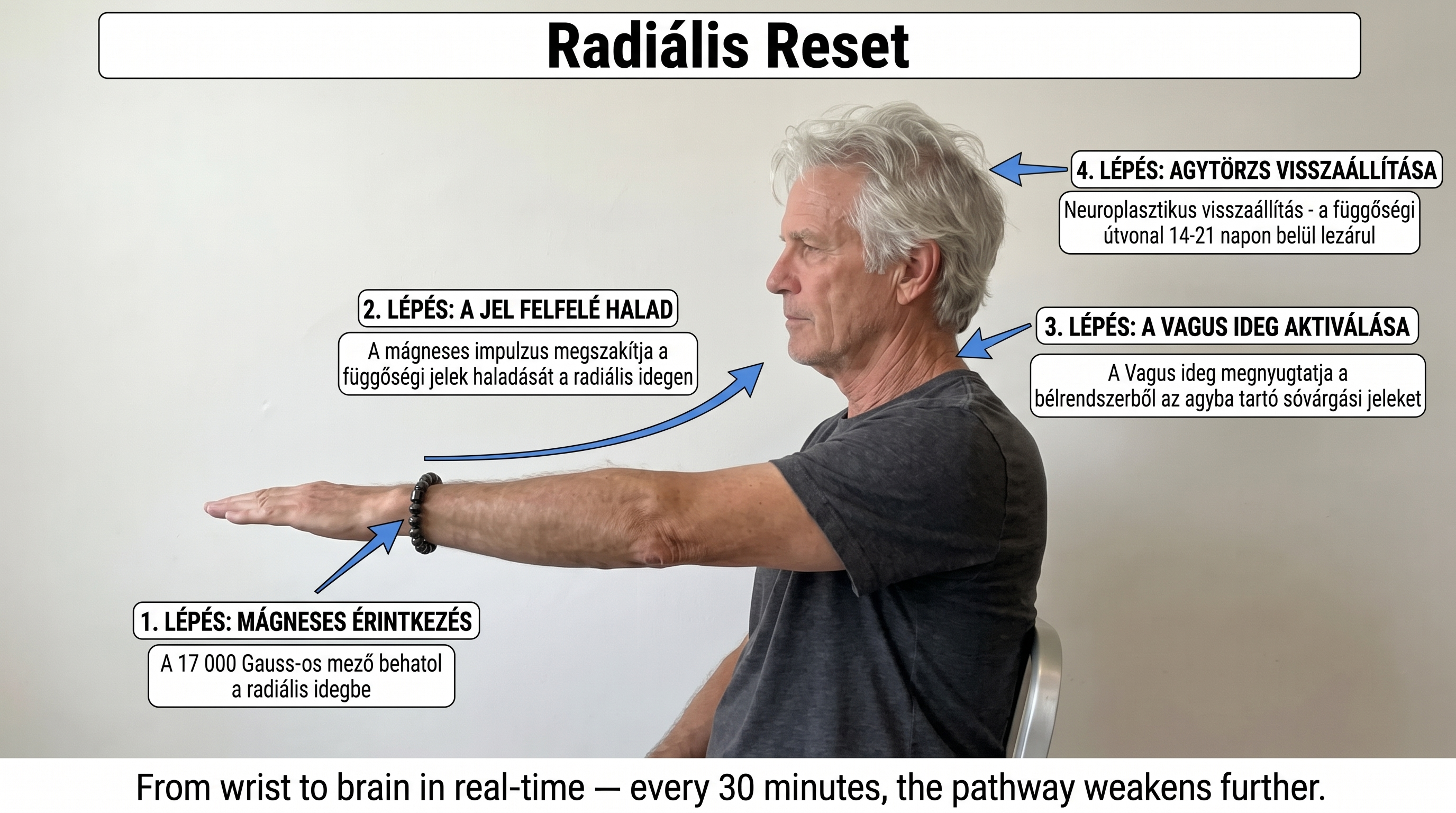 Infografic: cei patru pași ai Resetului Radial