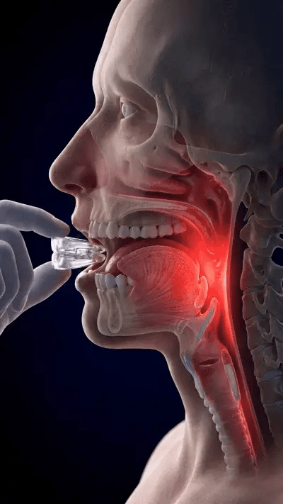 Ilustrație anatomică a maxilarului și căilor respiratorii cu dispozitiv